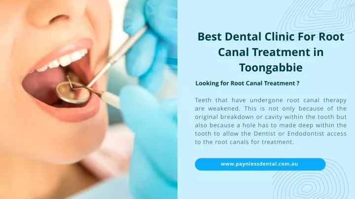 best dental clinic for root canal treatment