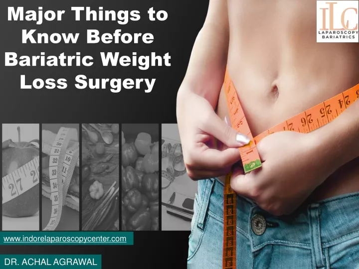 major things to know before bariatric weight loss