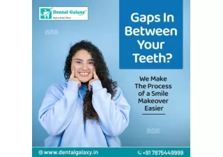 Gaps in your Teeth