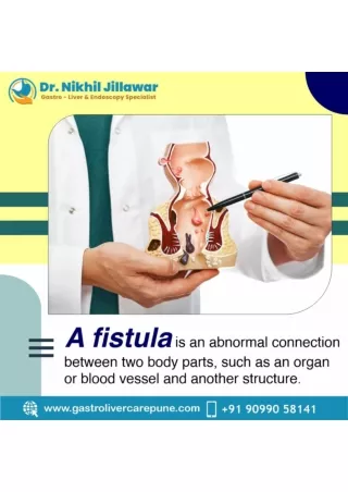 Anal Fistula Treatment in Pune
