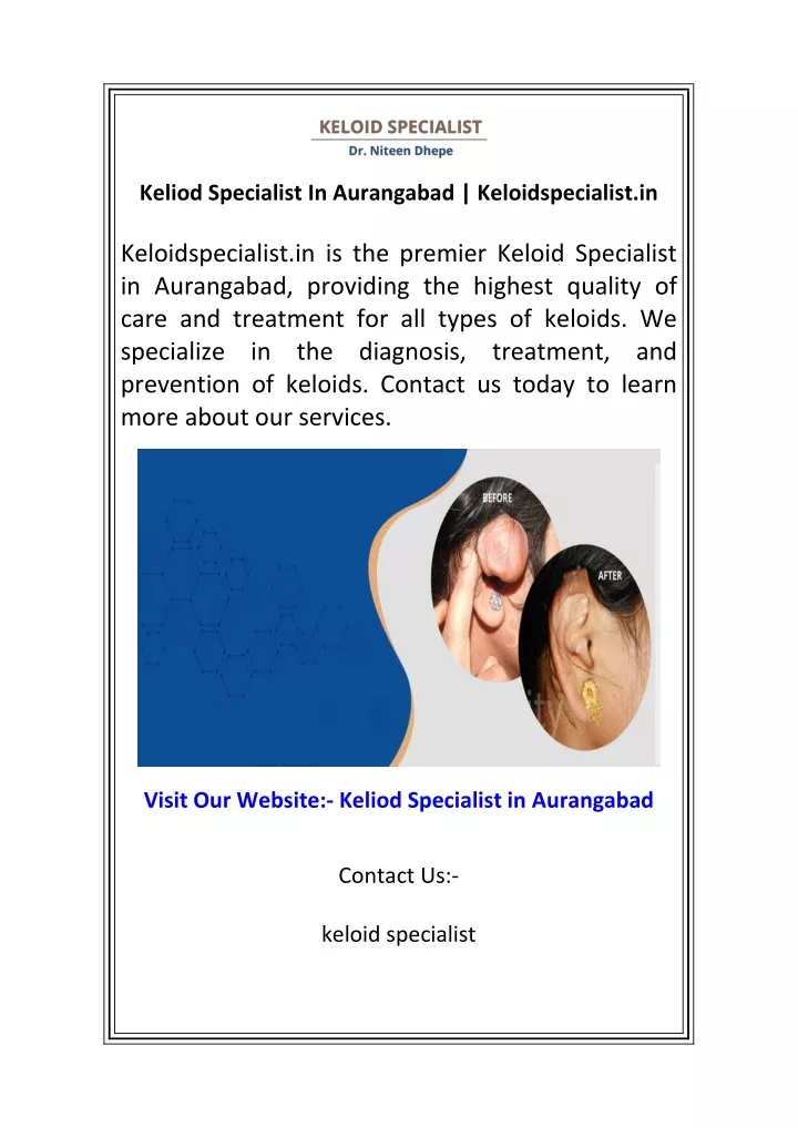 keliod specialist in aurangabad keloidspecialist