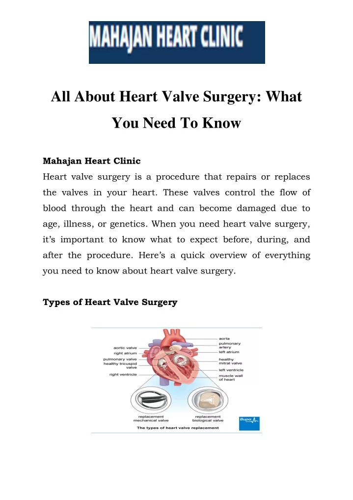 all about heart valve surgery what