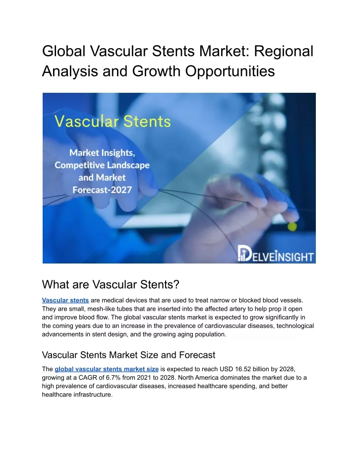 global vascular stents market regional analysis