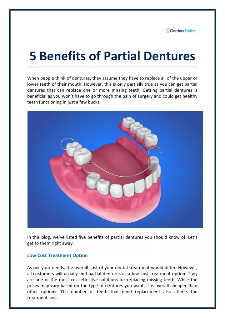 5 benefits of partial dentures when people think