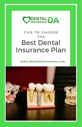 Tips To Select The Best Dental Insurance Plan