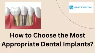 How to Choose the Most Appropriate Dental Implants?