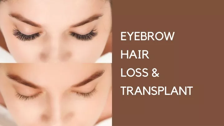 eyebrow hair loss transplant