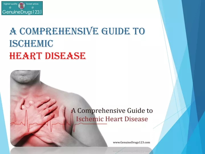 a comprehensive guide to ischemic heart disease