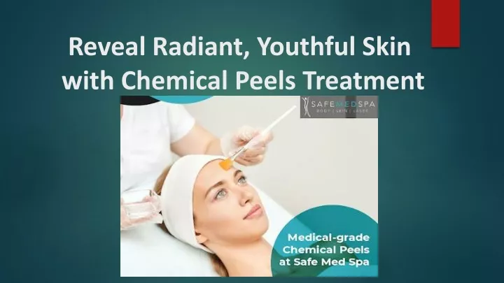 reveal radiant youthful skin with chemical peels treatment