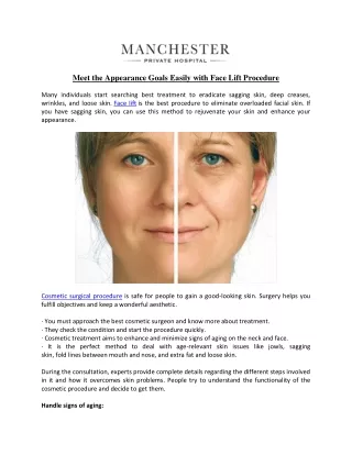 Meet the Appearance Goals Easily with Face Lift Procedure