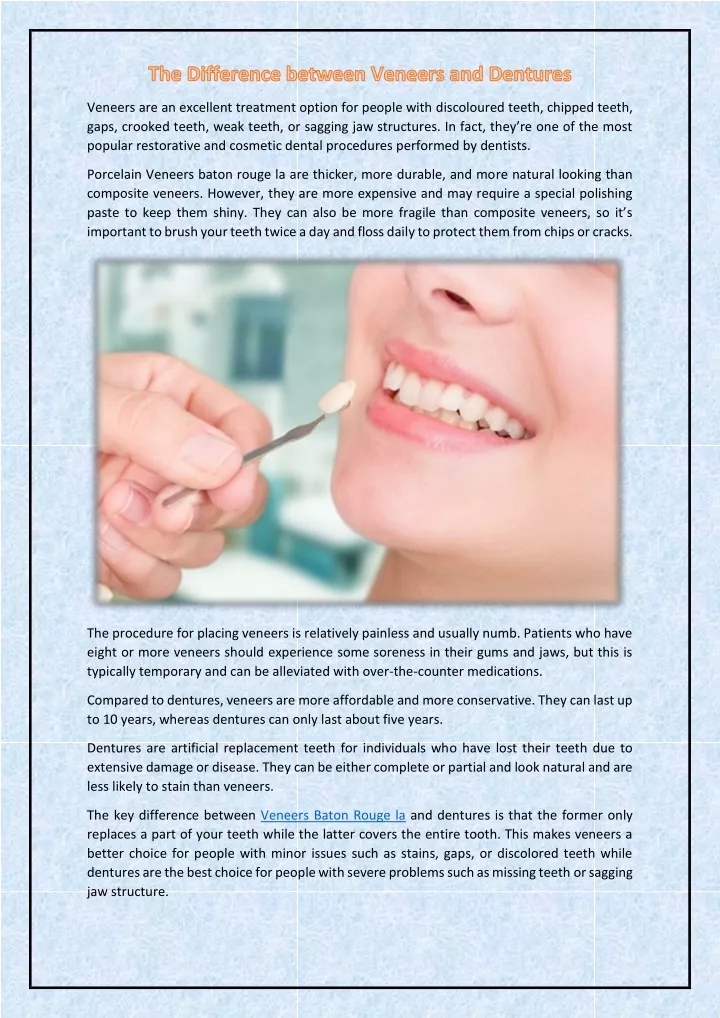 veneers are an excellent treatment option