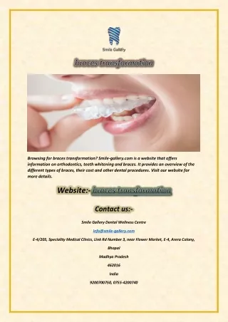 browsing for braces transformation smile gallery