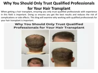 Why You Should Only Hire Professionals With Experience in Hair Transplantation