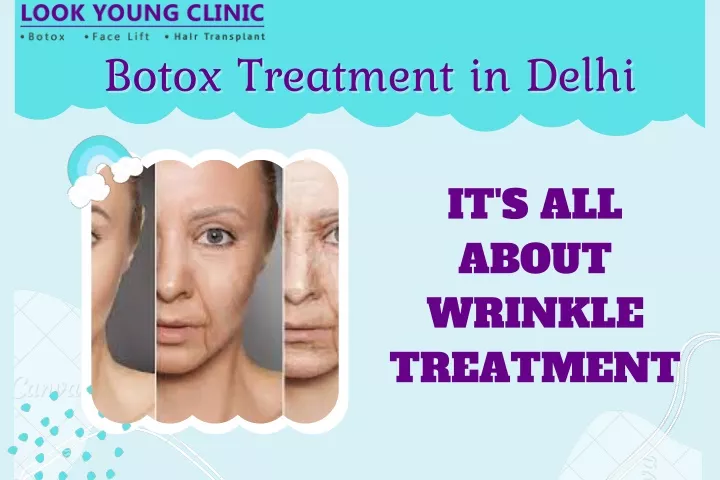 botox treatment in delhi