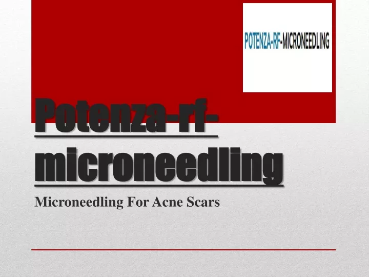 potenza rf microneedling