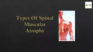 types of spinal muscular atrophy