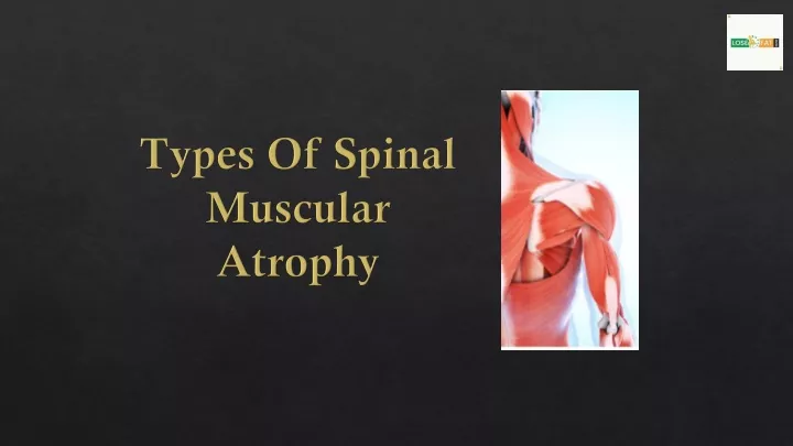 types of spinal muscular atrophy