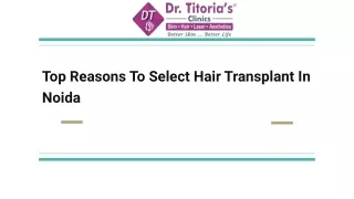 Top Reasons To Select Hair Transplant In Noida