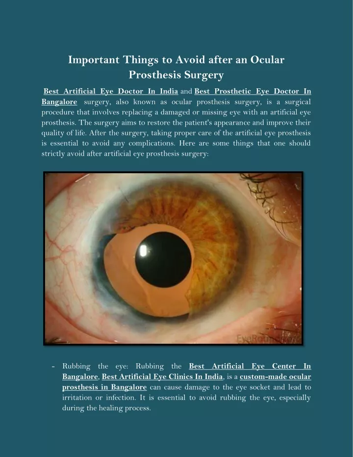 important things to avoid after an ocular