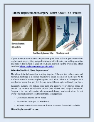 Elbow Replacement Surgery- Learn About The Process