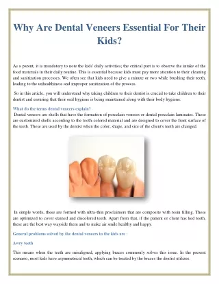 Why Are Dental Veneers Essential For Their Kids?