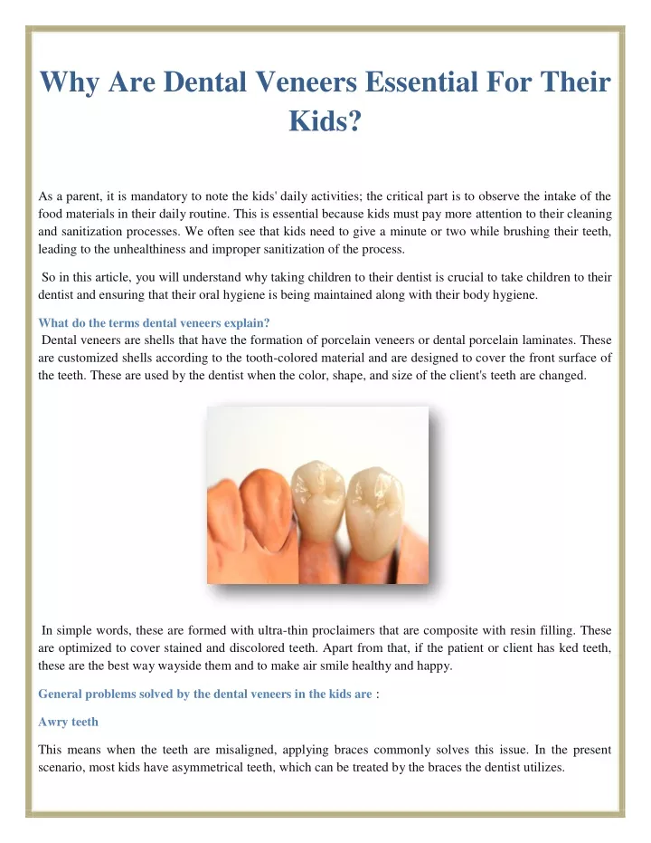 why are dental veneers essential for their kids