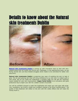 Details to know about the Natural skin treatments Dublin