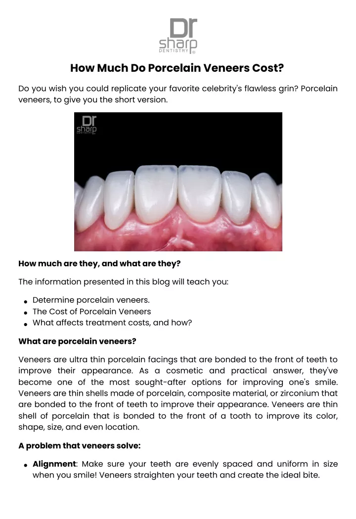 how much do porcelain veneers cost