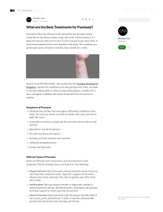 What are the Best Treatments for Psoriasis?
