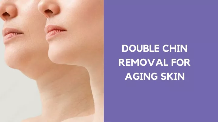 double chin removal for aging skin