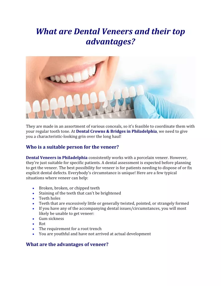 what are dental veneers and their top advantages