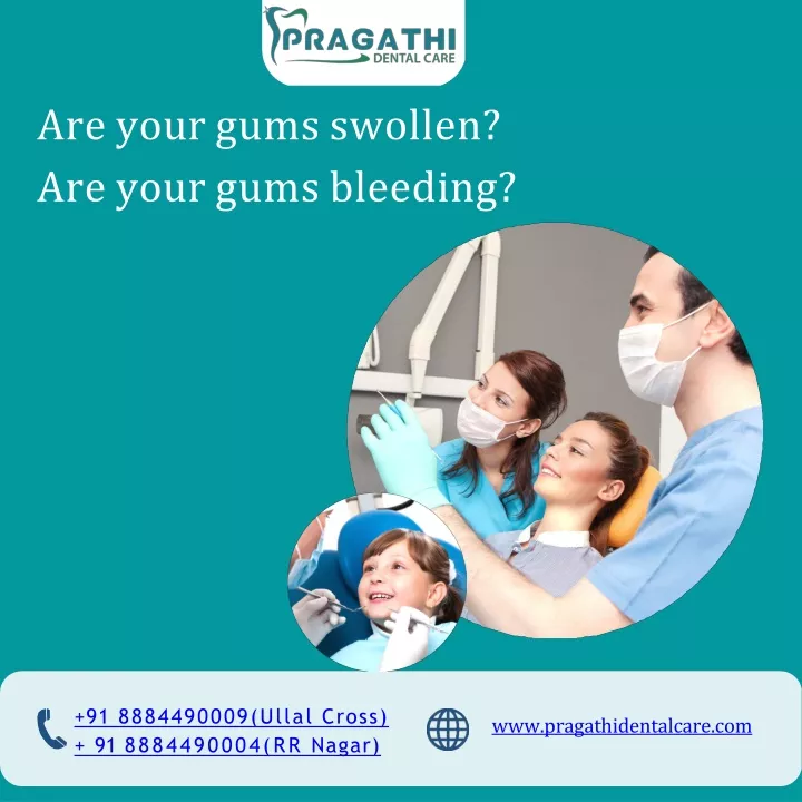are your gums swollen are your gums bleeding