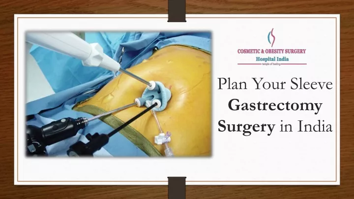 plan your sleeve gastrectomy surgery in india