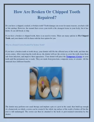 How Are Broken Or Chipped Tooth Repaired?