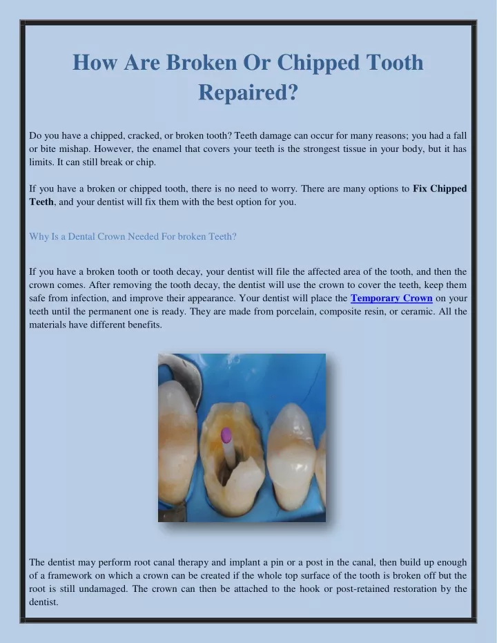 how are broken or chipped tooth repaired