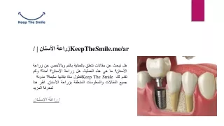 زراعة الأسنان | /KeepTheSmile.me/ar
