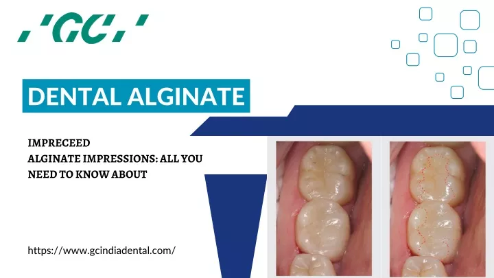 dental alginate