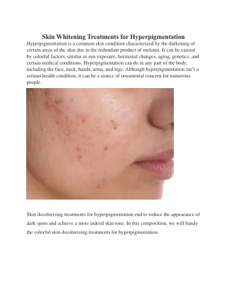Skin Whitening Treatments for Hyperpigmentation