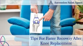 Speed Up Your Recovery: Expert Tips for a Successful Knee Replacement