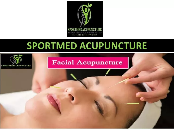 sportmed acupuncture