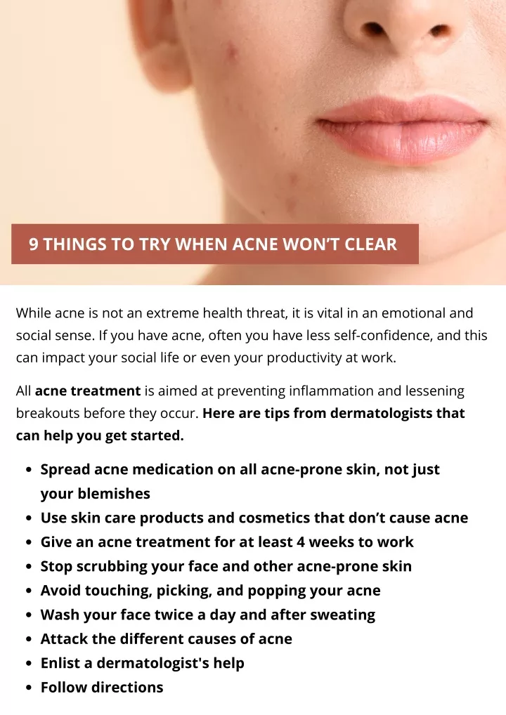 9 things to try when acne won t clear
