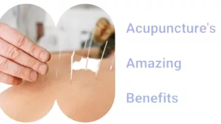 Acupuncture's Amazing Benefits