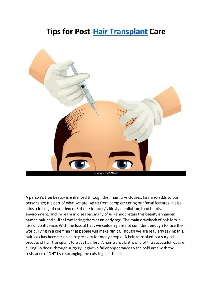 tips for post hair transplant care