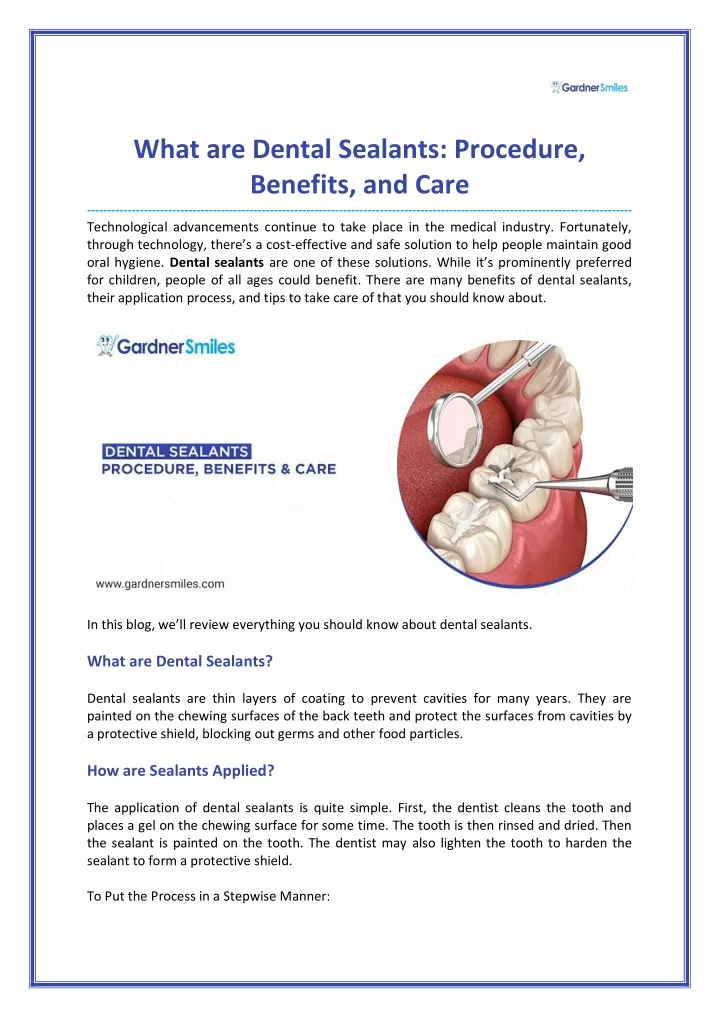 what are dental sealants procedure benefits