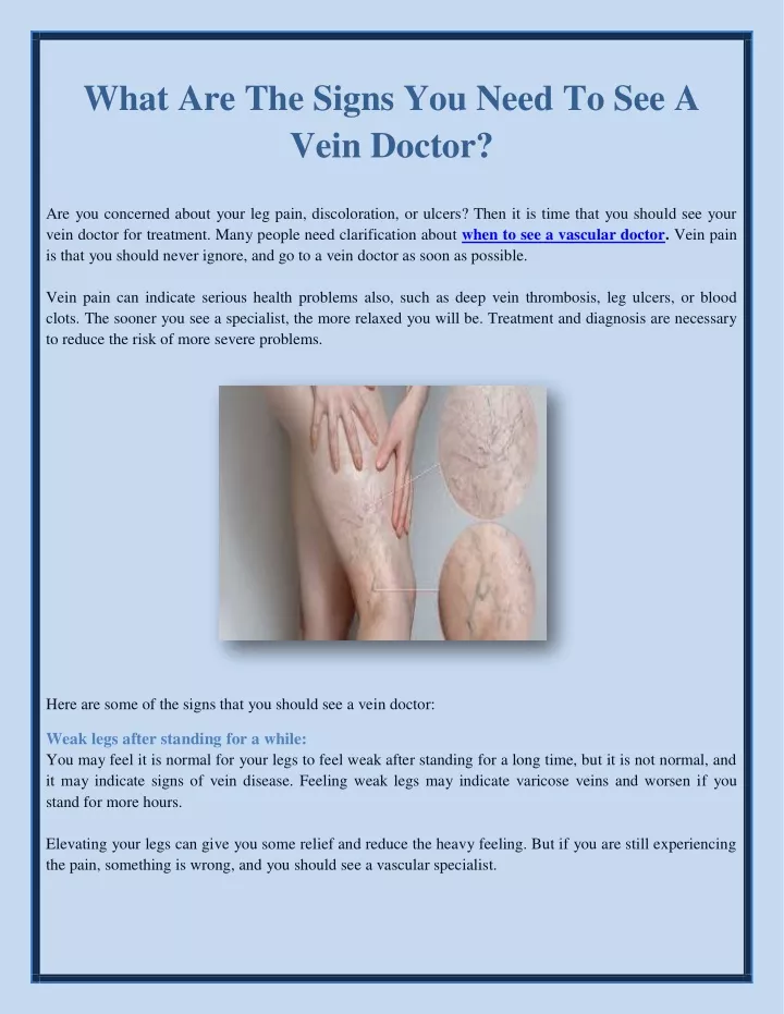 what are the signs you need to see a vein doctor