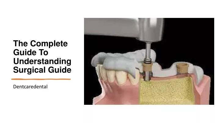 the complete guide to understanding surgical guide