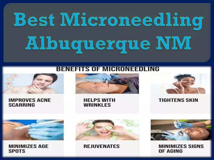 best microneedling albuquerque nm
