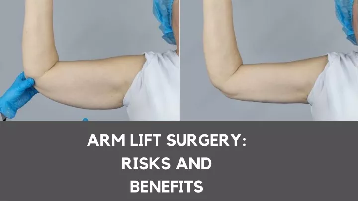 arm lift surgery risks and benefits