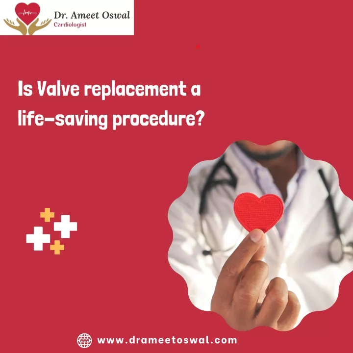 is valve replacement a life saving procedure
