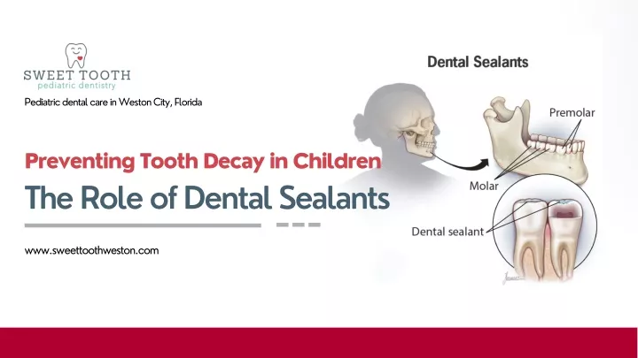 pediatric dental care in weston city florida